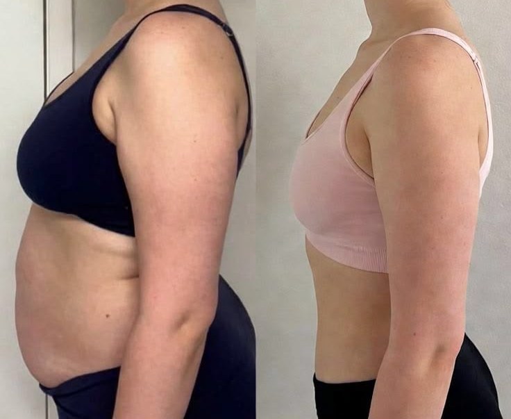 Antes e depois de aluno