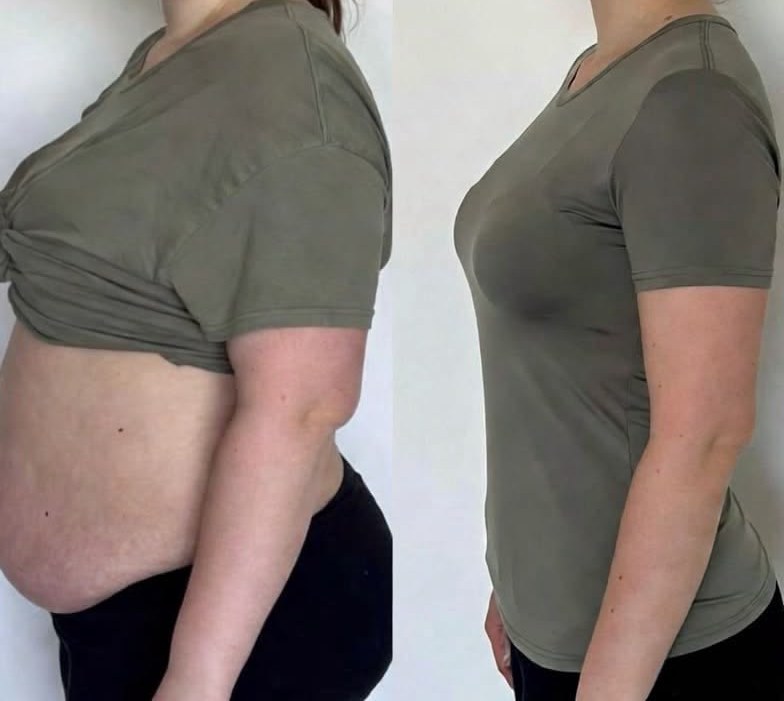 Antes e depois de aluno